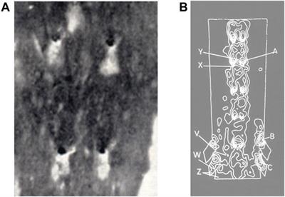 Haemodynamic Wall Shear Stress, Endothelial Permeability and Atherosclerosis—A Triad of Controversy